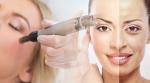 ISPEGLAJTE BORE uz prirodni botox - iglična MEZOTERAPIJA botopeptidima u Medelina Health Studiu u Zagrebu uz dr. Sanju Jeleković!