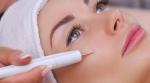 Uklonite neželjene KAPILARE s lica u Beauty Centru Kozlinger u Zagrebu - BEZBOLNO RJEŠENJE estetskog problema vidljivih kapilara uz STRUČNJAKE!