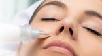 Neugodne bradavice, fibrome i keratoze UKLONITE bezbolno uz PLASMA PEN u Beauty centru Kozlinger u Zagrebu - uklanjanje 1 ili do 10 izraslina!