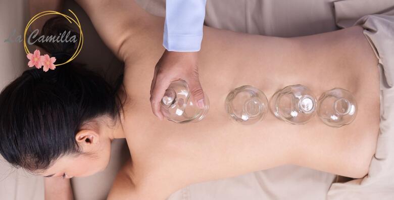 Medicinska masaža leđa i cupping terapija - prirodan put do olakšanja boli, opuštanja mišića i bolje cirkulacije u La Cammila Beauty Baru