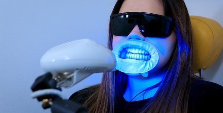 IZBJELJIVANJE ZUBI - bez oštećivanja cakline uz inovativnu Smilite LED tehnologiju i Opalescence Boost gel