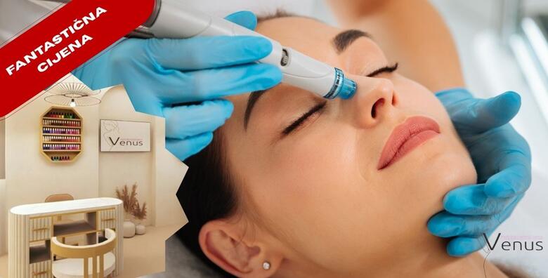 JEDINSTVENA "ONE-TIME" PONUDA - HYDRAFACIAL tretman u NOVOOTVORENOM Medicinsko estetskom centru Venus by Lucija Šarić u SESVETAMA